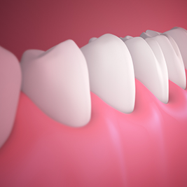 Treatment - smilemakerdentalcare