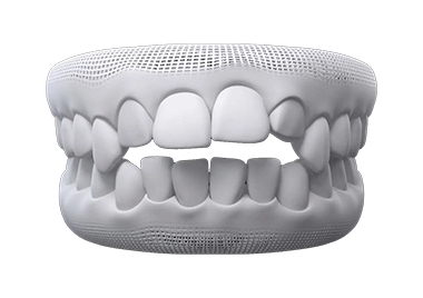 invisalign before after